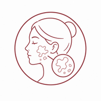 VITILIGO